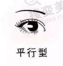 双眼皮的形状有哪些？哪种双眼皮适合你呢？