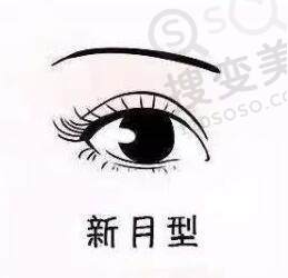 双眼皮的形状有哪些？哪种双眼皮适合你呢？