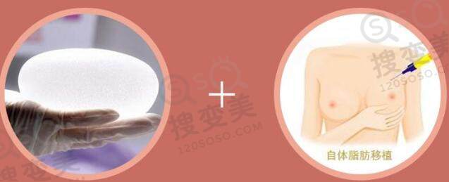 复合隆胸是什么？有什么好处？