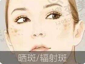 光子嫩肤有何好处？