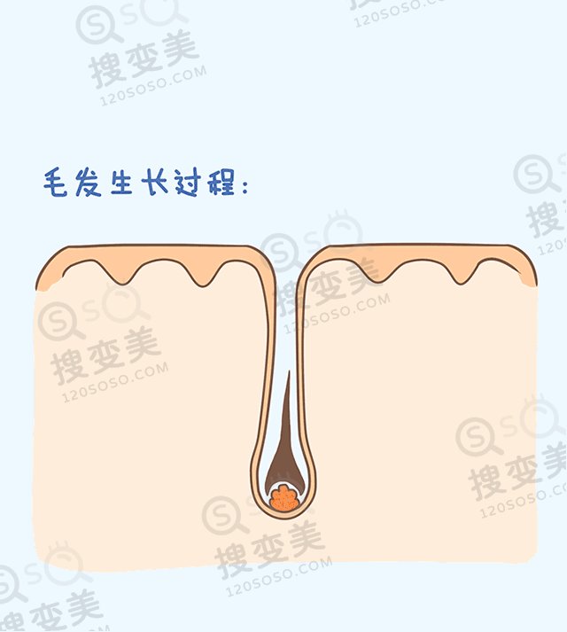 植发流程是怎么样的