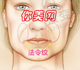 怎么去除法令纹