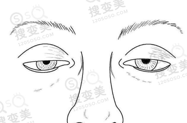 上睑下垂的治疗方式有？