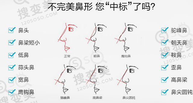 玻尿酸隆鼻之后还可以做假体隆鼻吗