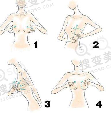 产后乳房下垂的原因及改善方法