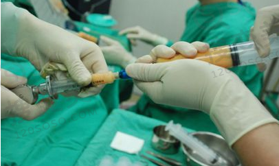 产后乳房下垂的原因及改善方法