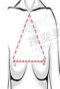 关于胸部外扩