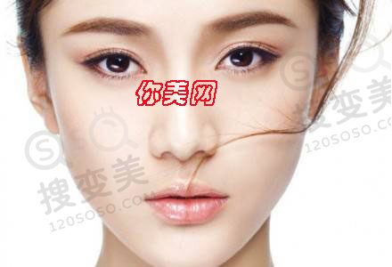 假体隆鼻注意这6点离成功便不远了