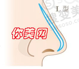 假体隆鼻注意这6点离成功便不远了