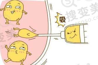 吸脂去副乳的注意事项