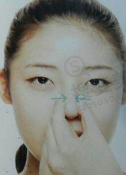 捏鼻子鼻梁会变高吗？