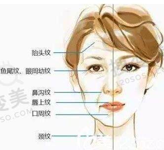 除皱到底是用玻尿酸好还是除皱瘦脸好？