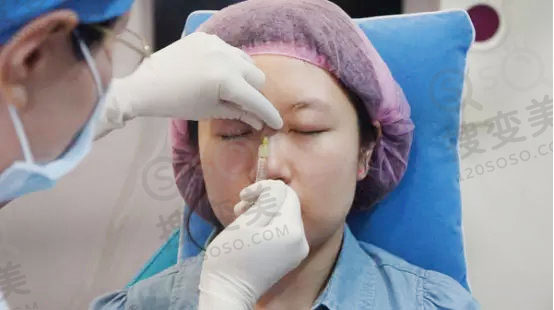 玻尿酸注射隆鼻会让鼻子变宽吗