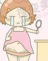 激光去妊辰纹的价格