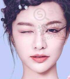 自体脂肪填充加PRP真的可以提高***吗？