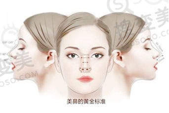 隆鼻整形常见的六大问题解答