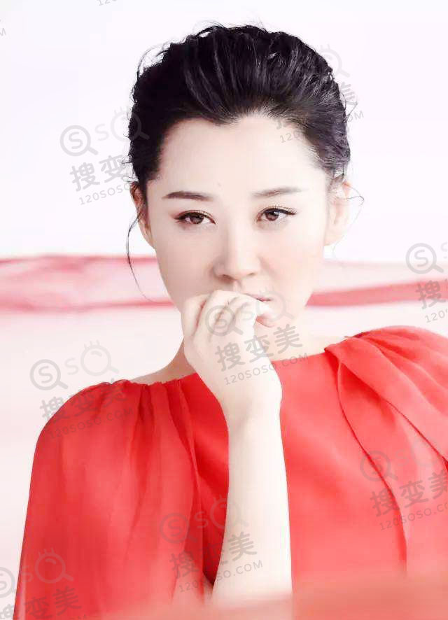 杭州发际线调整需要大约需要多少钱？