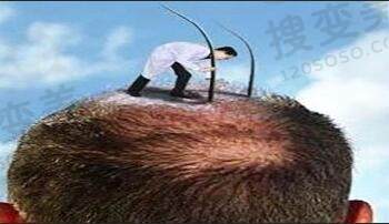 植发对身体有什么伤害吗？
