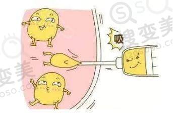 吸脂