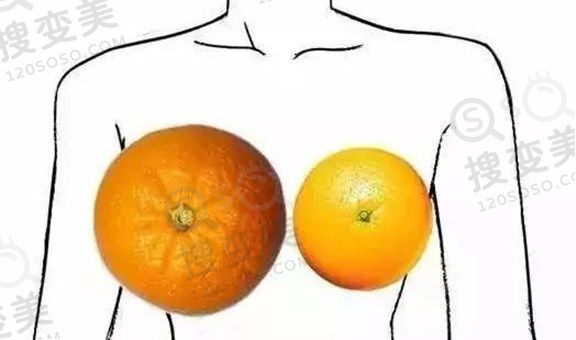 乳房大小