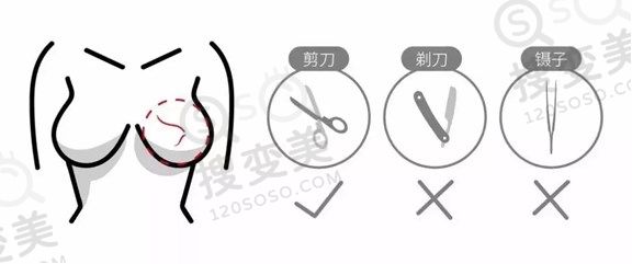 乳头毛发