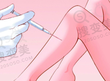 瘦腿针注射后腿会肿吗，为什么会肿呢