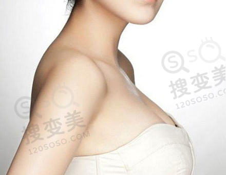 假体隆胸会影响到哺乳吗