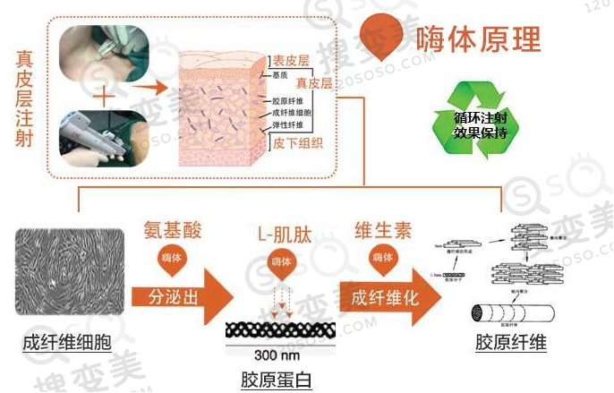 嗨体的原理