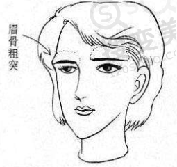 眉骨突出