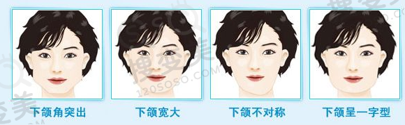 下颌角整形术后为什么出现少数骨增生的情况？