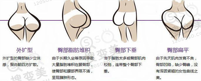 玻尿酸丰臀和自体脂肪丰臀哪个好？
