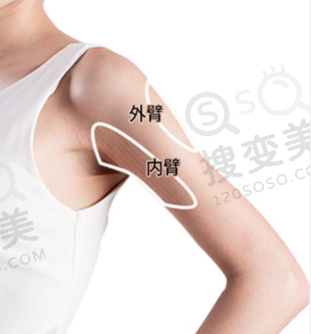 吸脂瘦手臂