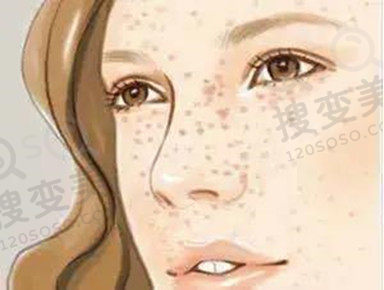 色斑久治不愈，治疗后反黑怎么办？