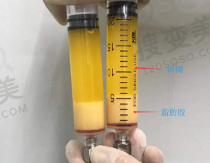 脂肪胶是什么