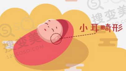 小耳畸形需外耳再造