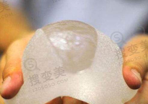 假体隆胸多年后需要取出吗?