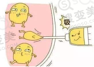 吸脂的原理