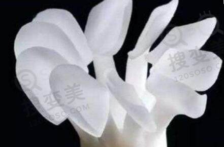 瓷贴面