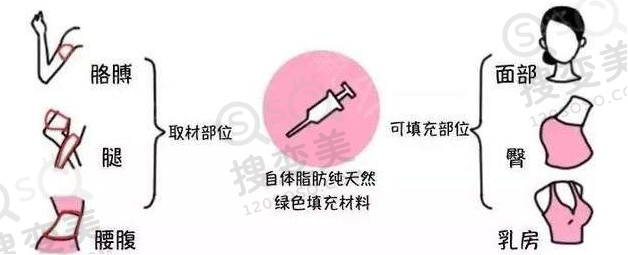 自体脂肪填充抽什么部位脂肪更好？