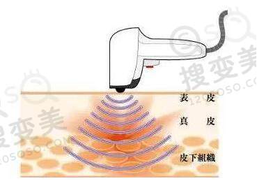 热拉提