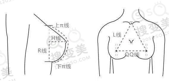 乳房外扩