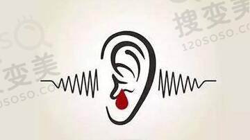 小耳畸形