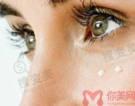 成都拉双眼皮整形医院哪里好