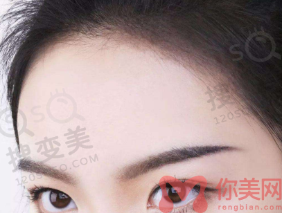 种发际线需要多少钱