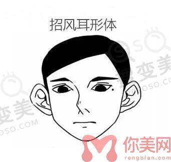 成都招风耳矫正多少钱？