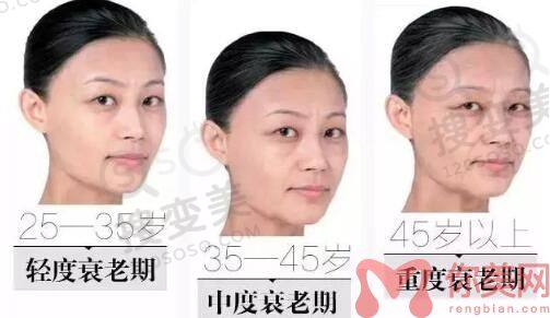 线雕的线会凸出来吗？