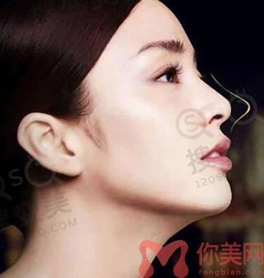 重庆华美整形美容医院