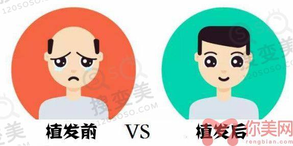 新生植发医院怎么样?正规吗