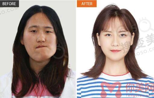 歪脸女孩