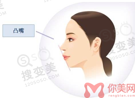 太原华美可以做凸嘴手术吗？